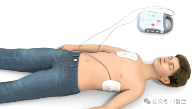 新生儿电极片怎么贴2025年美国AHA心肺复苏指南更新_https://www.jmylbn.com_新闻资讯_第27张