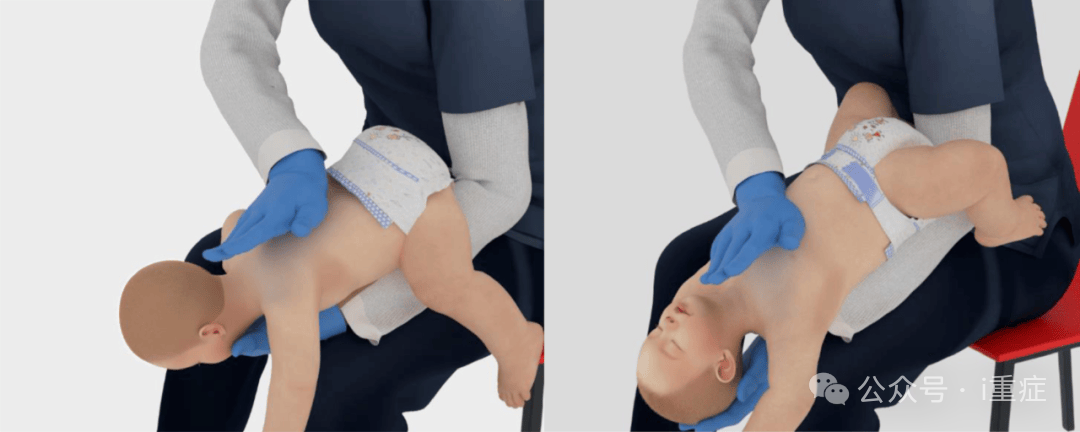 新生儿电极片怎么贴2025年美国AHA心肺复苏指南更新_https://www.jmylbn.com_新闻资讯_第16张