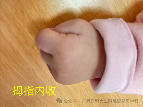 什么是ot训练当孩子遇到这些问题，可能需要OT（作业治疗）的帮助_https://www.jmylbn.com_新闻资讯_第9张