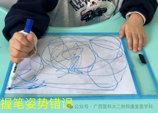 什么是ot训练当孩子遇到这些问题，可能需要OT（作业治疗）的帮助_https://www.jmylbn.com_新闻资讯_第15张