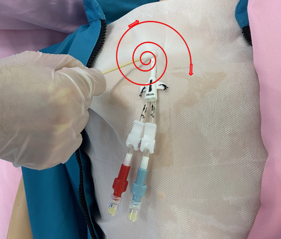 无菌纱块怎么使用一文让你学会透析导管自我换药_https://www.jmylbn.com_新闻资讯_第70张