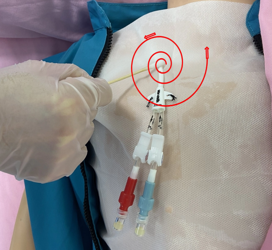 无菌纱块怎么使用一文让你学会透析导管自我换药_https://www.jmylbn.com_新闻资讯_第67张