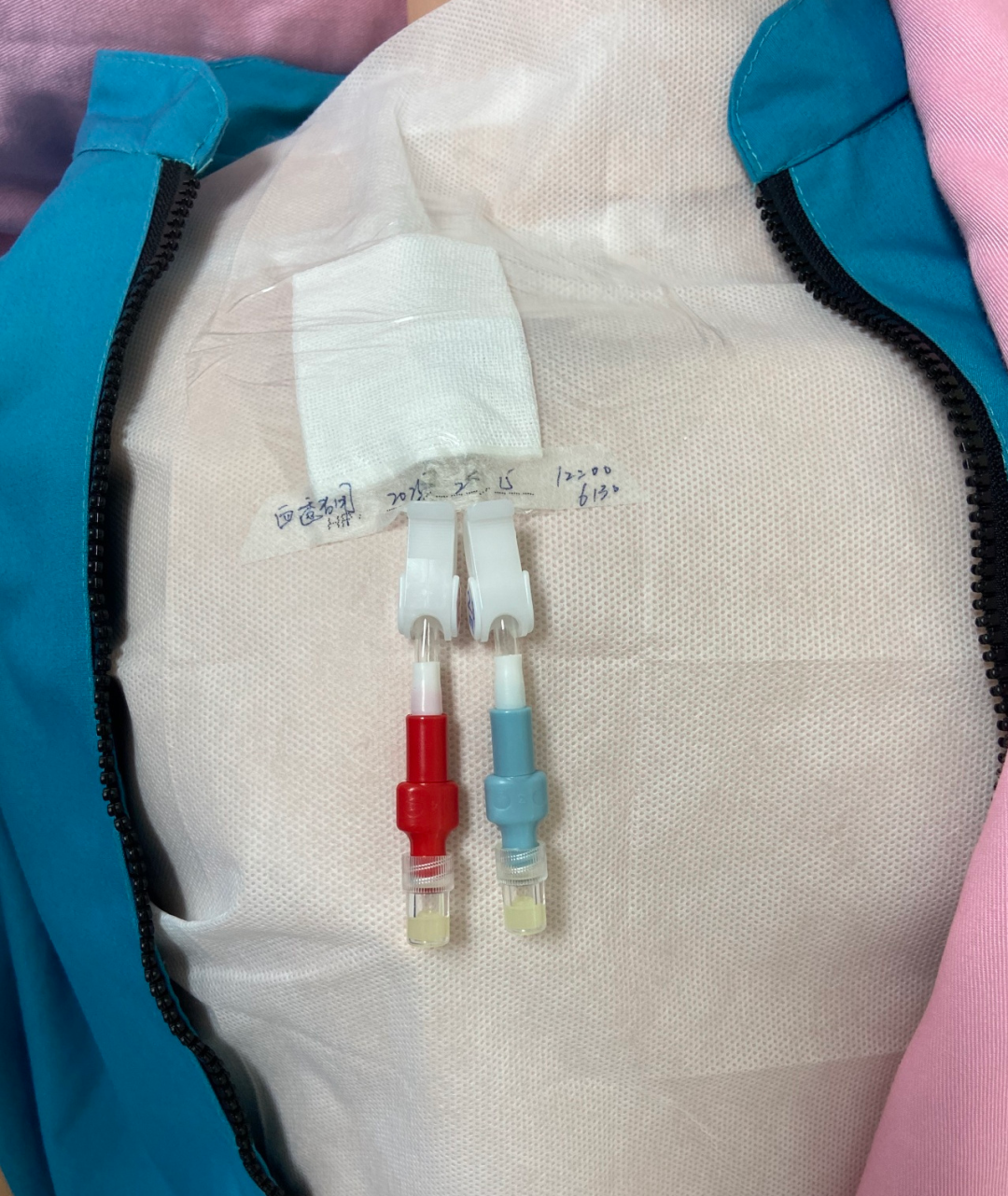 无菌纱块怎么使用一文让你学会透析导管自我换药_https://www.jmylbn.com_新闻资讯_第37张