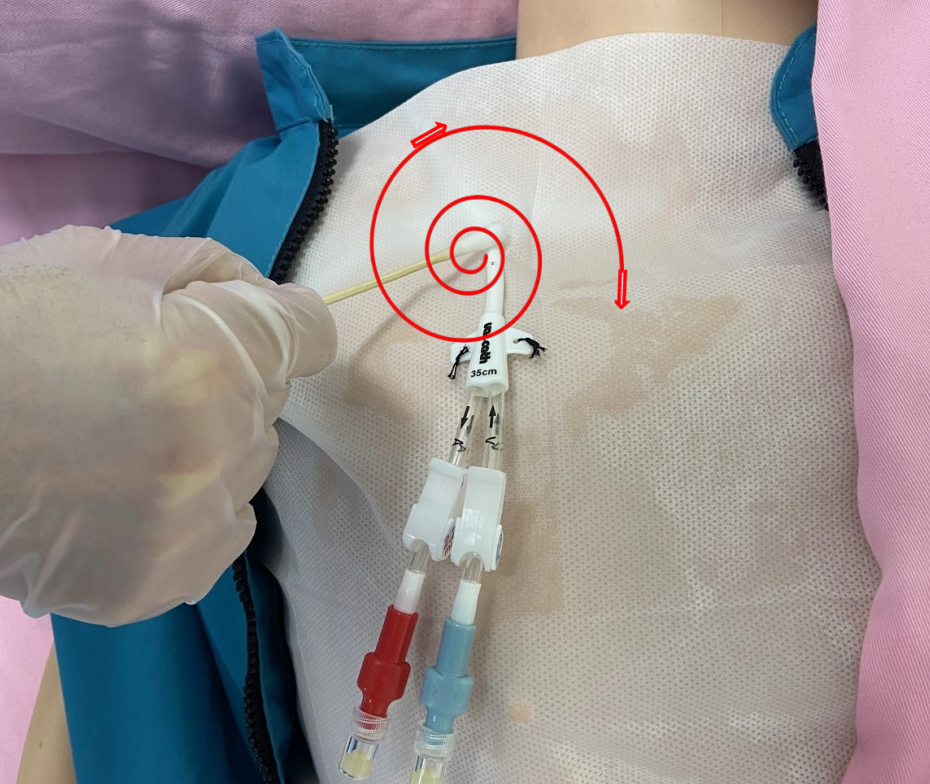 无菌纱块怎么使用一文让你学会透析导管自我换药_https://www.jmylbn.com_新闻资讯_第64张