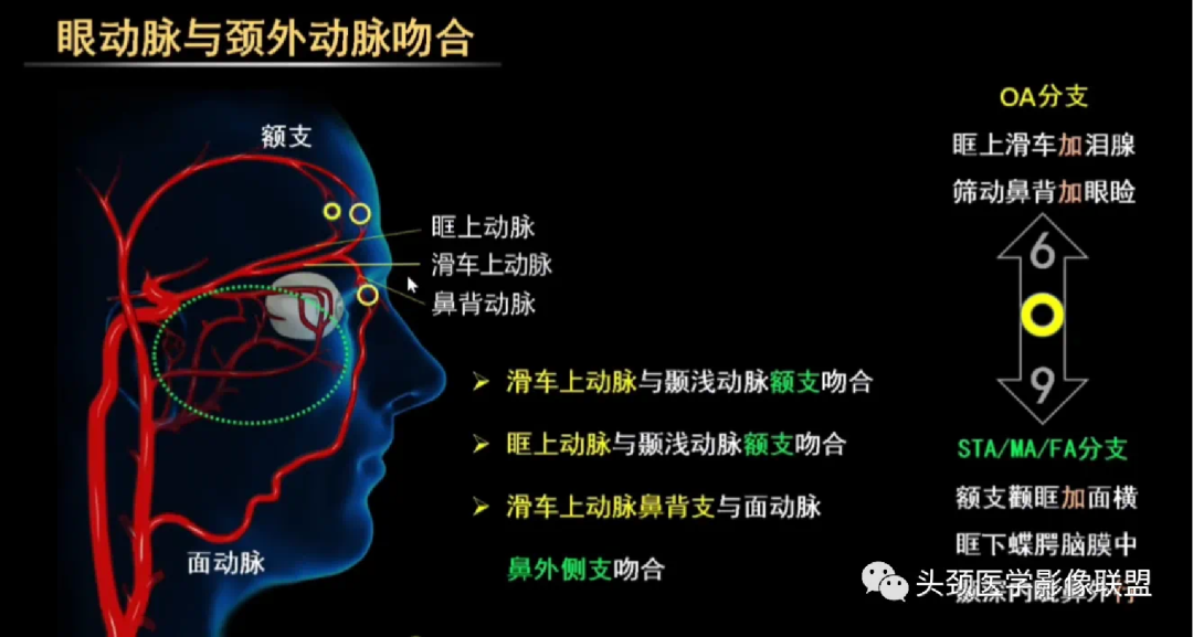 明胶在血管怎么降解前沿文献（第147期）视网膜母细胞瘤动脉内化疗中远端颈外动脉分支的可吸收明胶海绵栓塞_https://www.jmylbn.com_新闻资讯_第4张