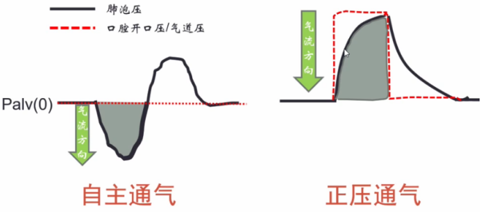 呼吸机呼气阀是什么如何正确使用无创正压通气治疗_https://www.jmylbn.com_新闻资讯_第3张