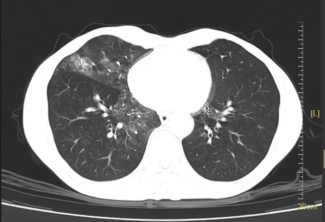 为什么要做吞咽仪器【康复加油站】吞咽障碍康复：打破“进食困境”，重享生活滋味_https://www.jmylbn.com_新闻资讯_第2张