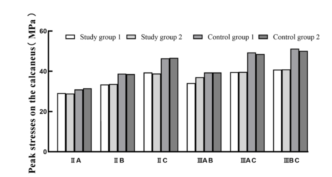 跟骨骨折：微创经皮螺钉固定的最佳螺钉分布及直径