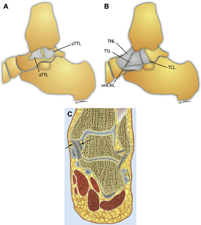 三角韧带损伤：何时修复以及如何修复？
