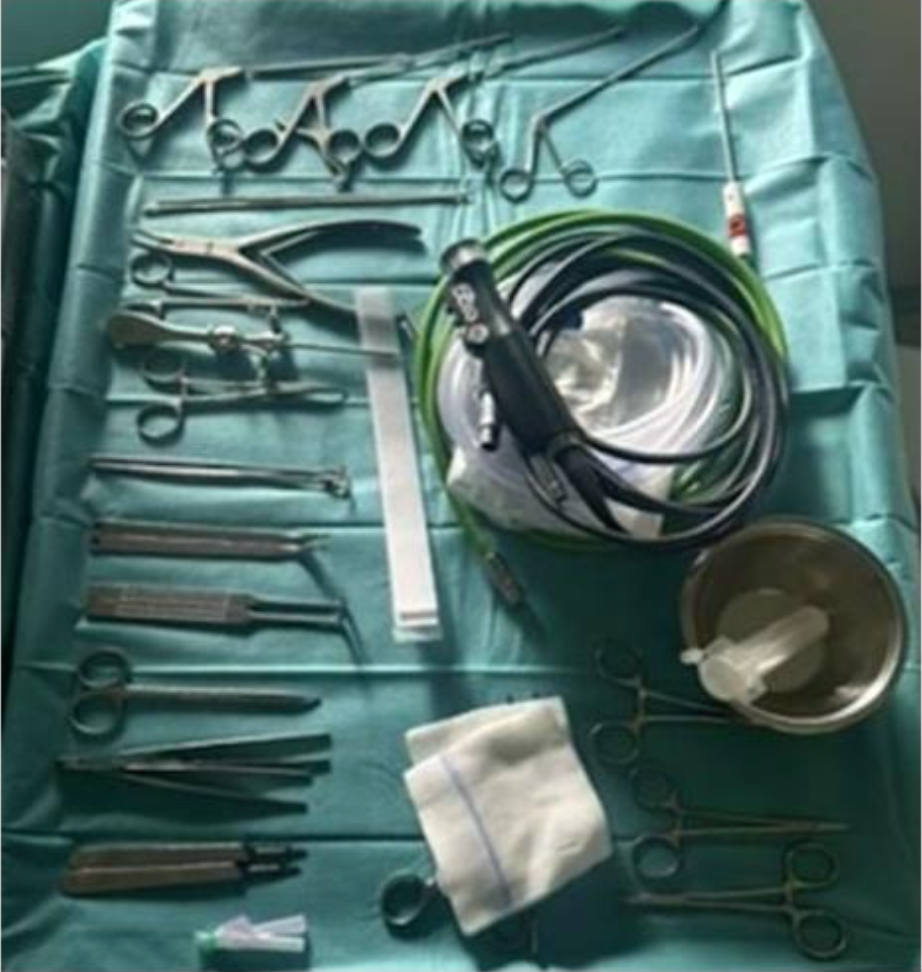 距骨骨软骨手术德国经验｜软骨成形术、逆行钻孔、微骨折术