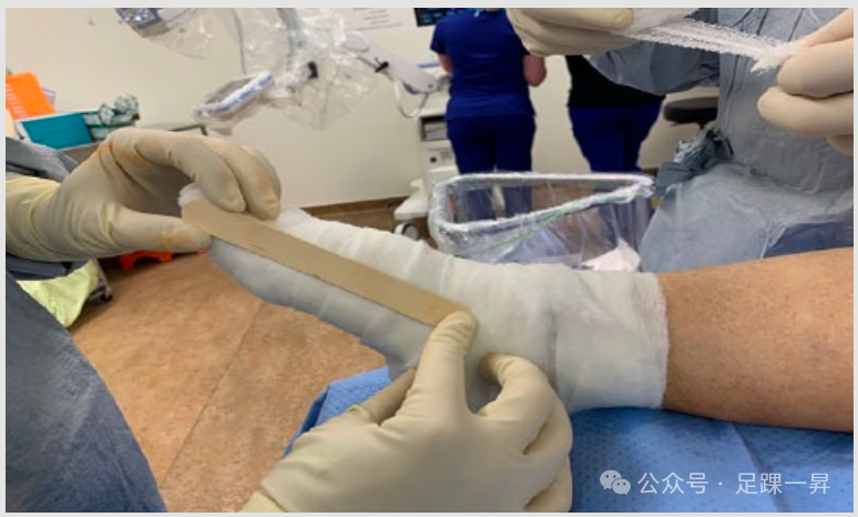 压舌板用纱布怎么包拇外翻｜术后压舌板敷料包扎技术_https://www.jmylbn.com_新闻资讯_第7张