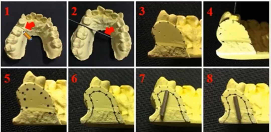 曲面断层片怎么看种植术前读片，学会看CBCT、曲断片、根尖片_https://www.jmylbn.com_新闻资讯_第4张