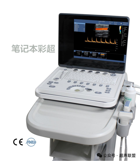 索诺星超声怎么样索诺星和理邦全新彩超机器_https://www.jmylbn.com_新闻资讯_第38张