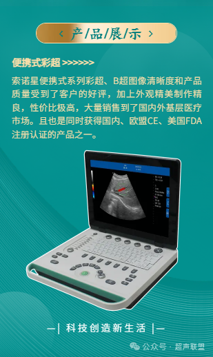 索诺星超声怎么样第五节.双眼眶切面广州索诺星无线掌超_https://www.jmylbn.com_新闻资讯_第9张