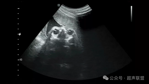 索诺星超声怎么样第五节.双眼眶切面广州索诺星无线掌超_https://www.jmylbn.com_新闻资讯_第2张