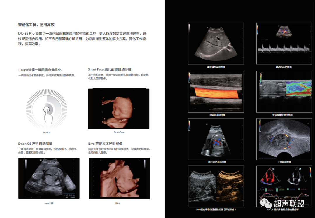 迈瑞彩超有哪些型号迈瑞彩超机器_https://www.jmylbn.com_新闻资讯_第10张