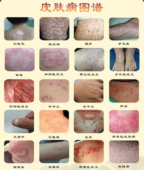 100种皮肤病对照图#皮肤病图片大全（100种皮肤病）