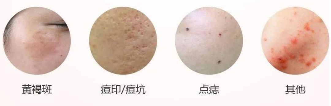 来吧！一键识别皮肤病，上100种皮肤病症状，总有你的