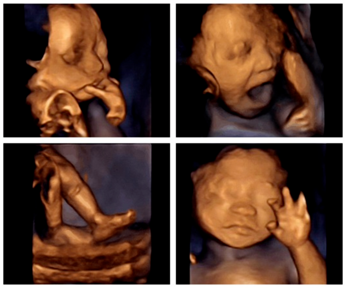 汕头彩超怎么样胎儿在＂宫内＂都在干嘛？为啥肚子总是一跳一跳的？「汕头妇产科医院」_https://www.jmylbn.com_新闻资讯_第6张