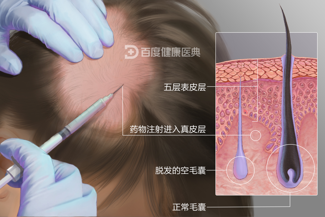 螺内酯片说明书图片