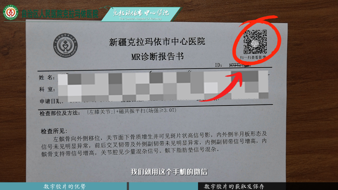 医用ct胶片怎么收纳“数字胶片”，随时随地看X线摄片、CT检查等影像资料！_https://www.jmylbn.com_新闻资讯_第10张