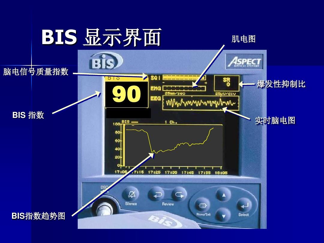 麻醉监测仪有哪些【麻醉监护设备】为生命护航的科技力量_https://www.jmylbn.com_新闻资讯_第12张