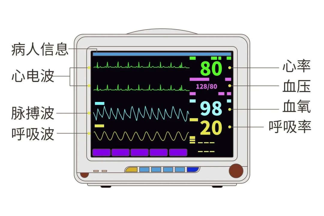 麻醉监测仪有哪些【麻醉监护设备】为生命护航的科技力量_https://www.jmylbn.com_新闻资讯_第8张