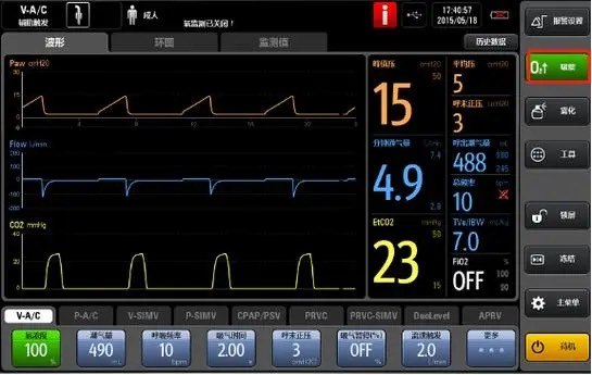 麻醉监测仪有哪些【麻醉监护设备】为生命护航的科技力量_https://www.jmylbn.com_新闻资讯_第10张