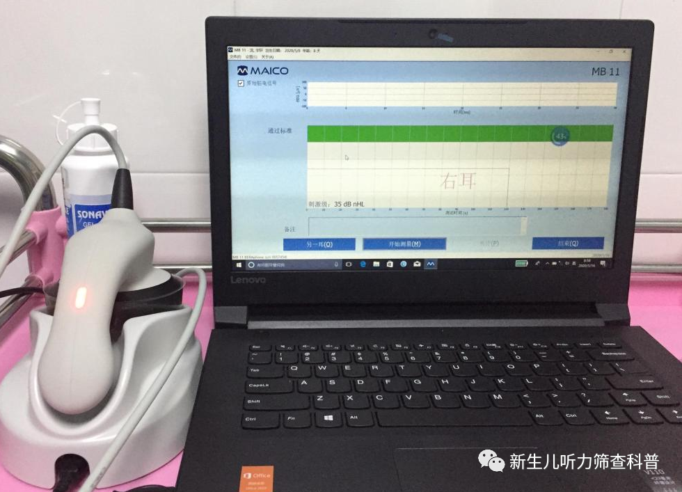 oae仪器怎么使用听力筛查过程中涉及的物品仪器有哪些？_https://www.jmylbn.com_新闻资讯_第6张