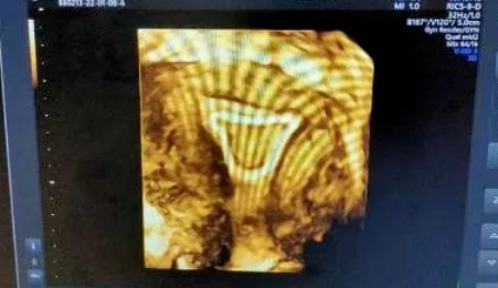 ge彩超怎么样康达医院引进国际领先金标版GE-E10四维彩超  提升我县妇幼健康服务能力_https://www.jmylbn.com_新闻资讯_第23张