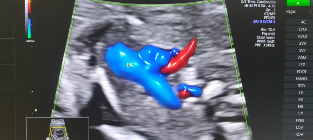 ge彩超怎么样康达医院引进国际领先金标版GE-E10四维彩超  提升我县妇幼健康服务能力_https://www.jmylbn.com_新闻资讯_第19张