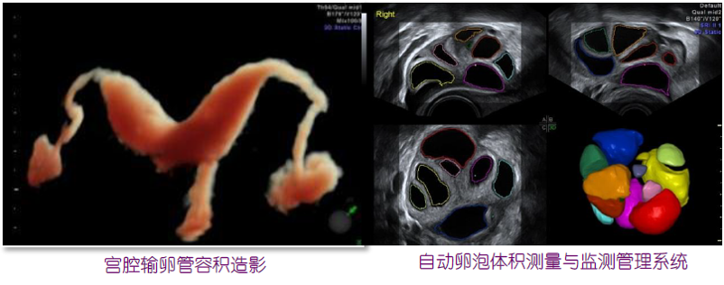 ge彩超怎么样康达医院引进国际领先金标版GE-E10四维彩超  提升我县妇幼健康服务能力_https://www.jmylbn.com_新闻资讯_第16张