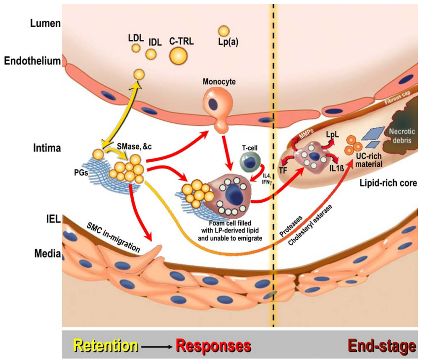 ZD治疗为什么很贵郑刚教授：晚期治疗是ASCVD残余风险的主要原因，“太多、太迟”的治疗模式亟待转变_https://www.jmylbn.com_新闻资讯_第2张