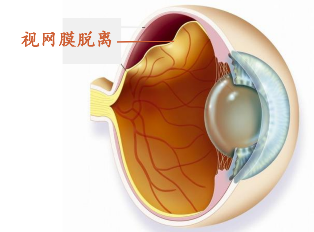 医院仪器怎么成像【资讯】国内率先使用！小儿眼底筛查智能化再进一步_https://www.jmylbn.com_新闻资讯_第5张