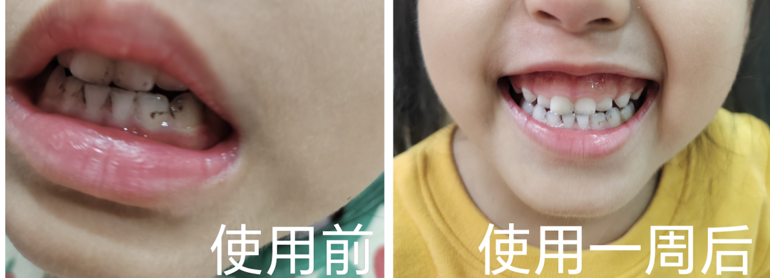 治疗床怎么用看着在治疗床上哇哇哭的孩子，“再也不敢了，这一件我还是老老实实给孩子买贵的…”_https://www.jmylbn.com_新闻资讯_第15张