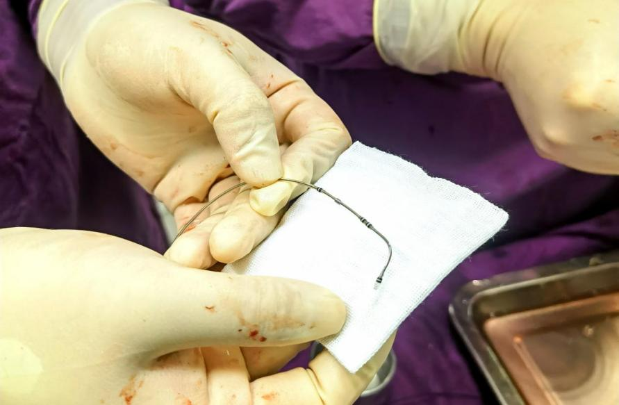心脏是怎么固定的仁医新术｜江西省心血管病医院完成省内首例主动固定式左室四极电极导线植入_https://www.jmylbn.com_新闻资讯_第3张