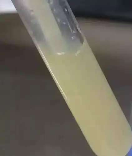 尿液引流袋怎么倒掉【大众健康】泌尿造口护理小妙招_https://www.jmylbn.com_新闻资讯_第13张