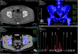医院仪器怎么成像【医院动态】库尔勒市第一人民医院医学影像科引进新设备，助推医院高质量发展_https://www.jmylbn.com_新闻资讯_第20张