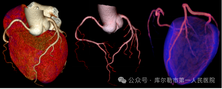 医院仪器怎么成像【医院动态】库尔勒市第一人民医院医学影像科引进新设备，助推医院高质量发展_https://www.jmylbn.com_新闻资讯_第7张