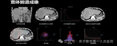 医院仪器怎么成像【医院动态】库尔勒市第一人民医院医学影像科引进新设备，助推医院高质量发展_https://www.jmylbn.com_新闻资讯_第21张