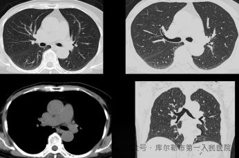 医院仪器怎么成像【医院动态】库尔勒市第一人民医院医学影像科引进新设备，助推医院高质量发展_https://www.jmylbn.com_新闻资讯_第14张