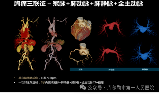 医院仪器怎么成像【医院动态】库尔勒市第一人民医院医学影像科引进新设备，助推医院高质量发展_https://www.jmylbn.com_新闻资讯_第17张
