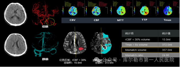 医院仪器怎么成像【医院动态】库尔勒市第一人民医院医学影像科引进新设备，助推医院高质量发展_https://www.jmylbn.com_新闻资讯_第11张