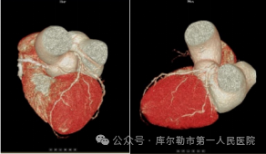 医院仪器怎么成像【医院动态】库尔勒市第一人民医院医学影像科引进新设备，助推医院高质量发展_https://www.jmylbn.com_新闻资讯_第13张