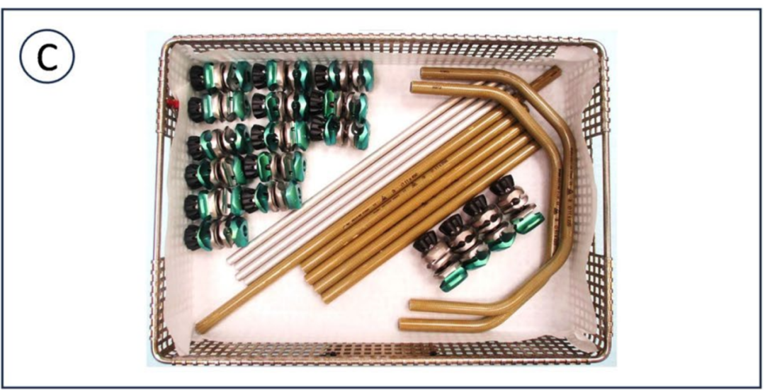 巧用外固定器：骨盆骨折经皮复位新方法