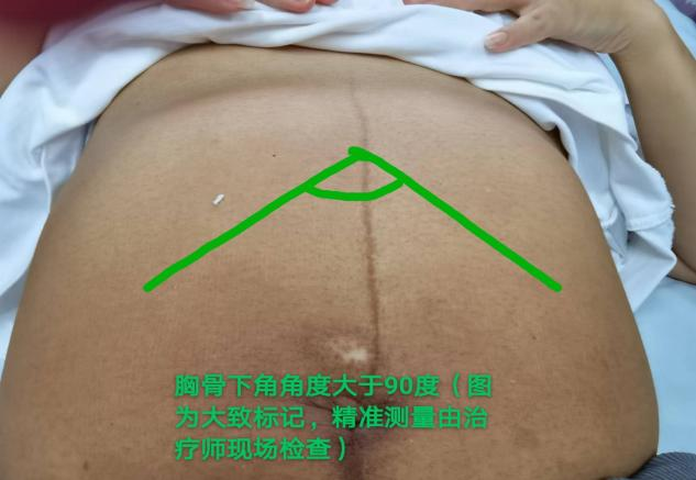 产后胸肋骨疼怎么回事产后妈妈容易忽略的健康问题——肋骨外翻_https://www.jmylbn.com_新闻资讯_第3张