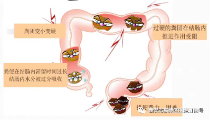 结肠灌洗怎么回事好消息 ll 高陵区医院肛肠科引进净水臭氧结肠灌洗机治疗便秘_https://www.jmylbn.com_新闻资讯_第10张
