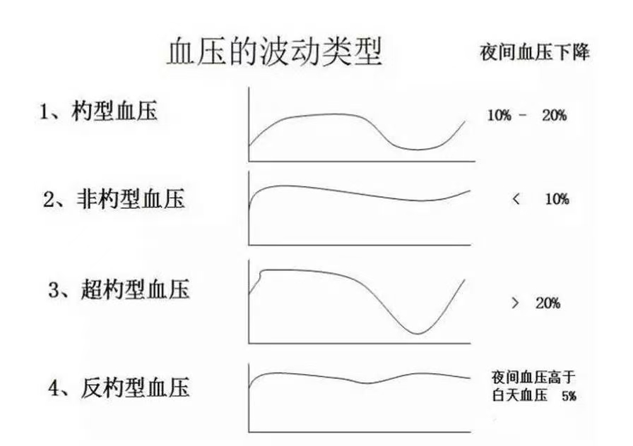 动态血压检测仪怎么看你的动态血压报告怎么看？一篇教你读懂“血压日记”_https://www.jmylbn.com_新闻资讯_第3张
