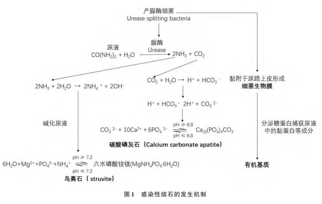 输尿管鞘是什么上尿路感染性结石诊断与治疗中国专家共识（2024版）_https://www.jmylbn.com_新闻资讯_第1张
