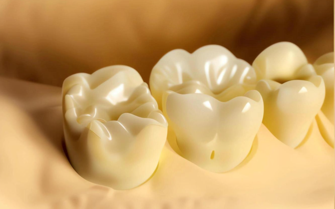 牙科材料硅胶怎么用如果你要做坏牙修复! 牙医告诉你怎么选材料和方案_https://www.jmylbn.com_新闻资讯_第10张